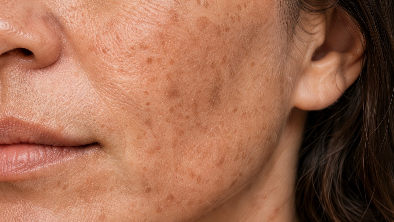 Skin with visible dark spots and uneven pigmentation