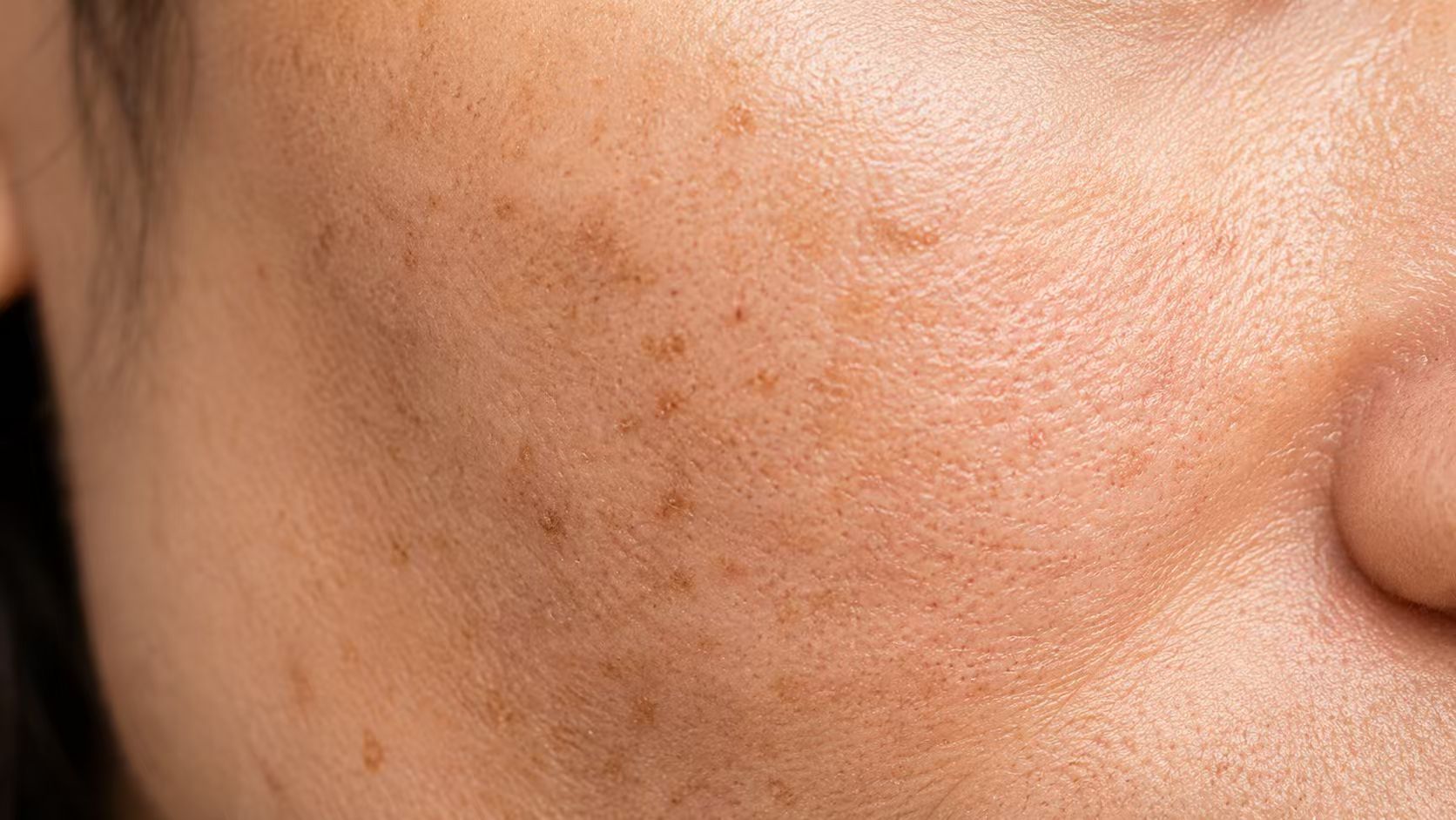 Close-up skin showing dull and uneven-looking tone